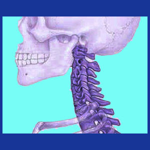 Ankylosing spondylitis in the neck