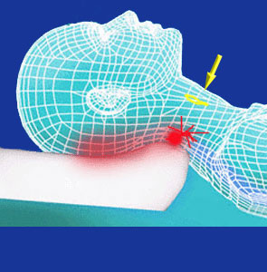 Anterior neck surgery