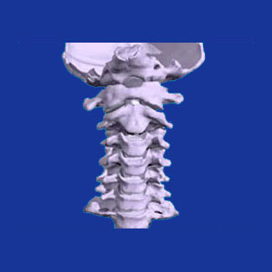 Arthritis neck pain