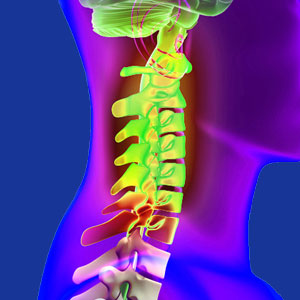 arthritis neck pain relief