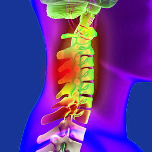 Cervical facet joint pain