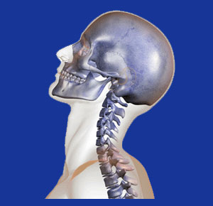 Cervical hyperlordosis