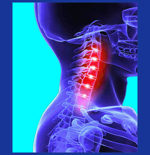 Cervical hypolordosis