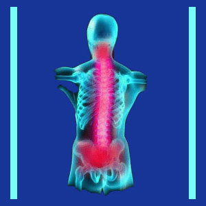 Cervical spinal cord injury