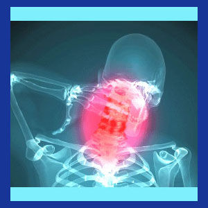 Cervical Spine Degeneration