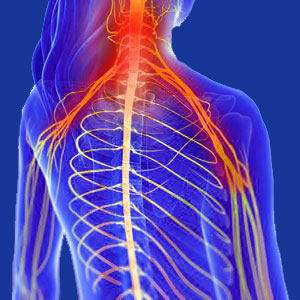 Cervical spine disorders