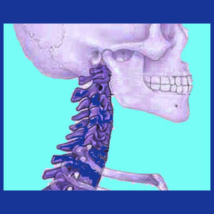 Cervical spondylitis