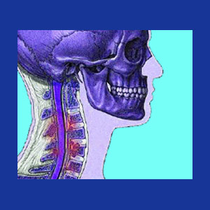 Cervical spondylosis