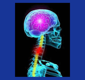 Cervical syringomyelia