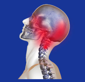 Cervicogenic Headache