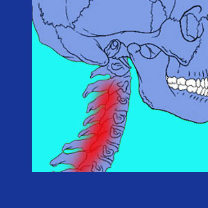 Coping with neck pain