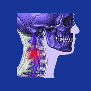 fractured vertebra in the neck