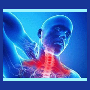 Idiopathic Neck Pain