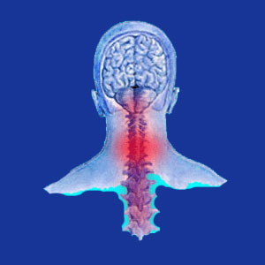 Ischemia neck pain