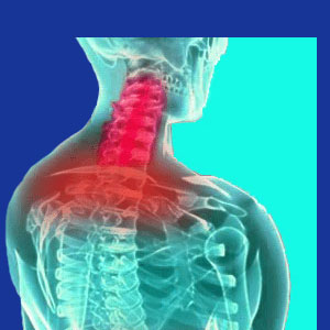 Lyme disease neck pain