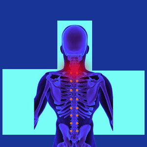 Mechanical neck pain