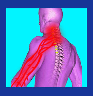 Neck and arm pain