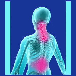 Neck and Back Pain