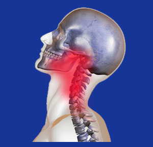 Neck and Jaw Pain