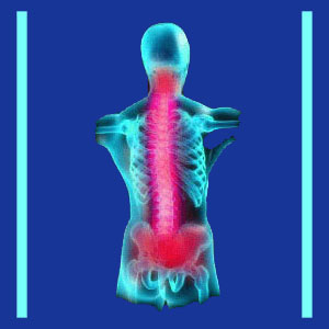 Neck and Lower Back Pain