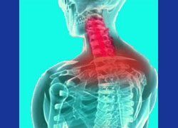 neck pain