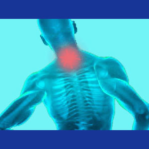 neck pain causes