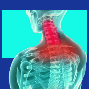 Neck pain in children