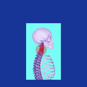 Neck Pain Management