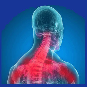 Neck pain symptoms
