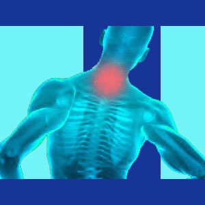 Neck pain treatment