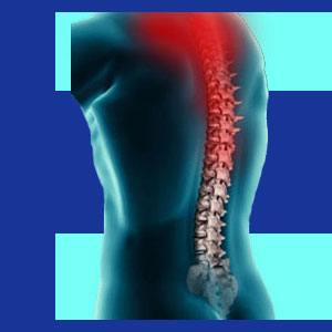 neurological effects of neck pain