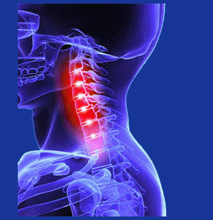 Osteoarthritis in the cervical spine