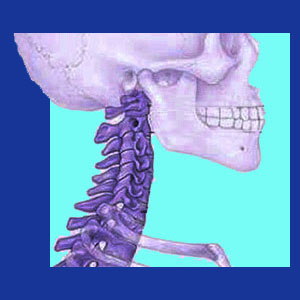 Osteoporosis neck pain