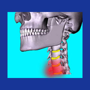 Pain in front of the neck