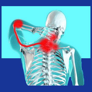 Pinched nerve neck pain