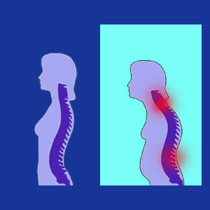 Posture neck pain