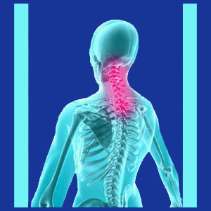 Relief from Cervical Spinal Stenosis