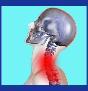 Shooting pain in the neck