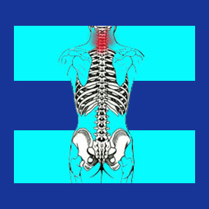 Spinal stenosis neck pain