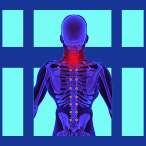 Tension myositis syndrome neck pain