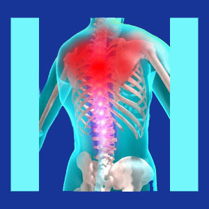 Thoracic outlet pain